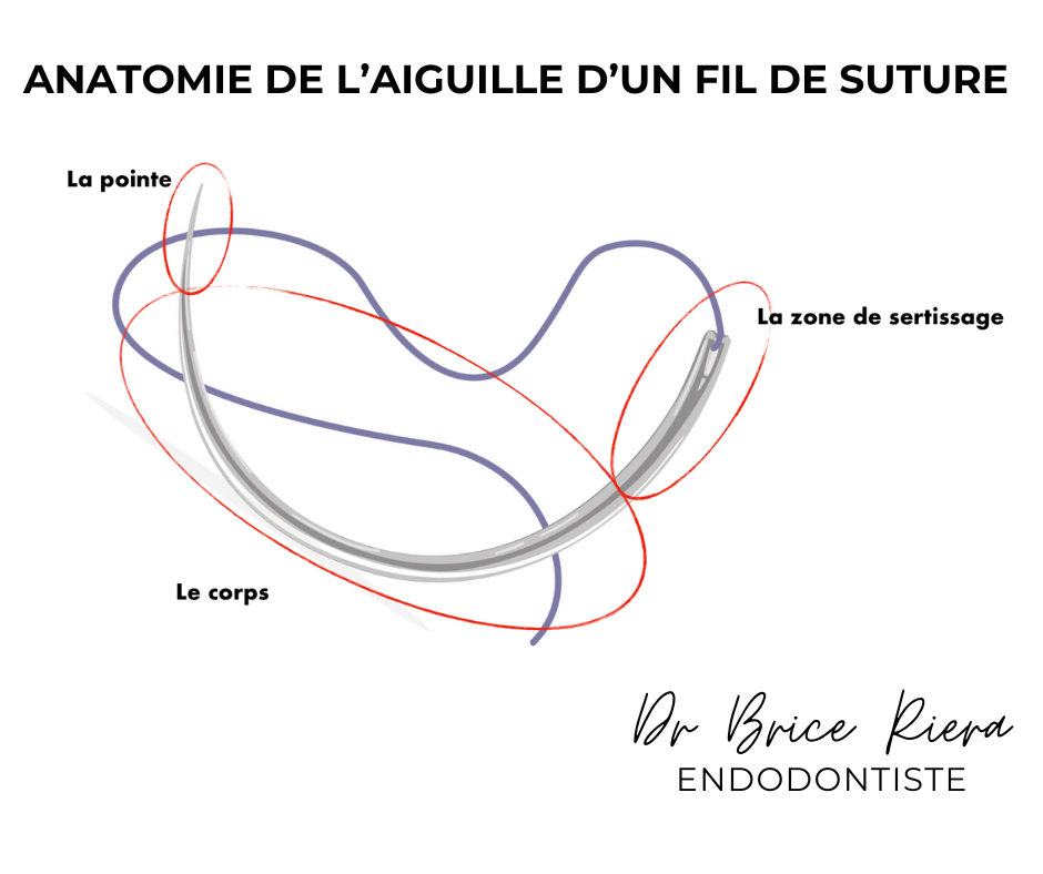 IG - fil de suture V2