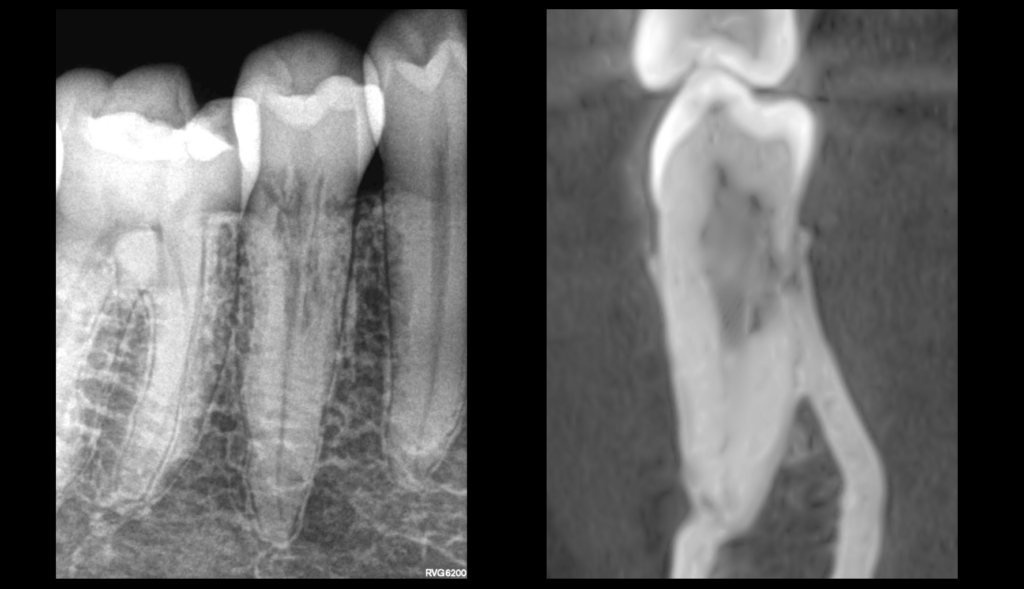 blog - dr brice riera - traiter ou surveiller