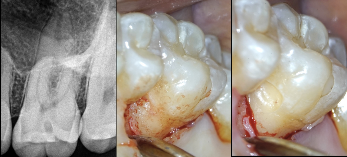 BLOG - Dr Brice Riera - Endodontie - ergonomie de travail