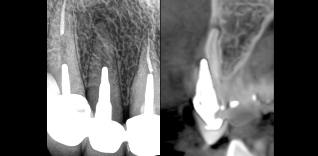 BLOG - Dr Brice Riera - elements radiographiques