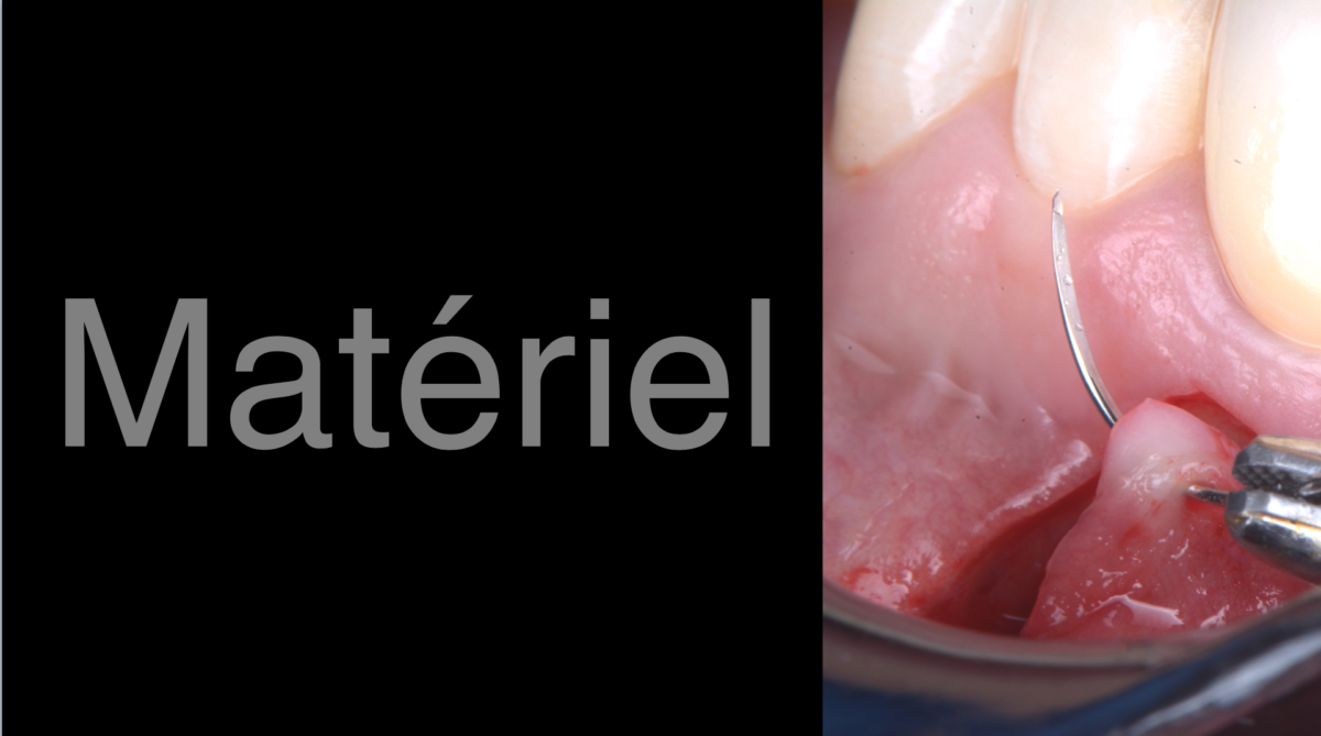 BLOG - Dr Brice Riera - preference de materiel endoodntique