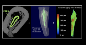 BLOG - Dr Brice Riera - PRRS - Chirurgien Dentiste