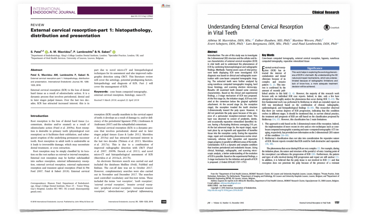 BLOG - Dr Brice Riera - résorptions radiculaires cervicales