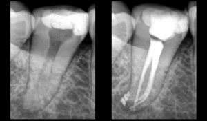 BLOG - Dr BRice riera - la thixotropie