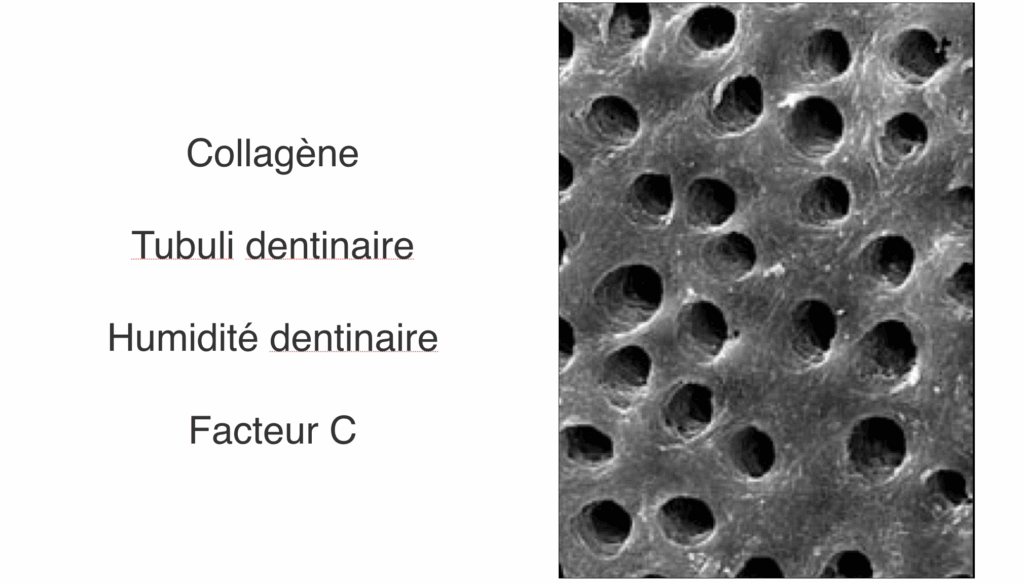 BLOG - Dr Brice Riera - Endodontie - dentine radiculaire