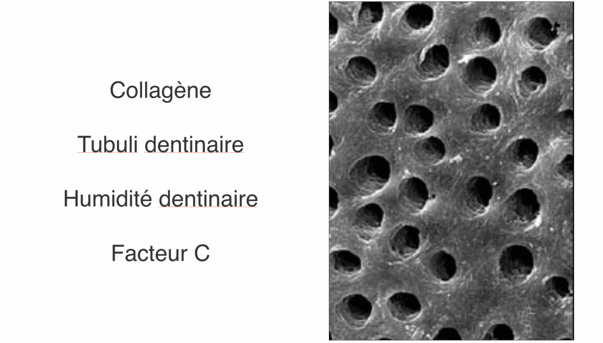 BLOG - Dr Brice Riera - Endodontie - dentine radiculaire