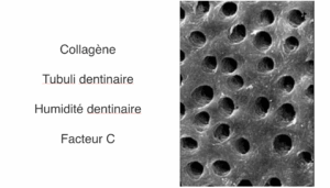 BLOG - Dr Brice Riera - Endodontie - dentine radiculaire