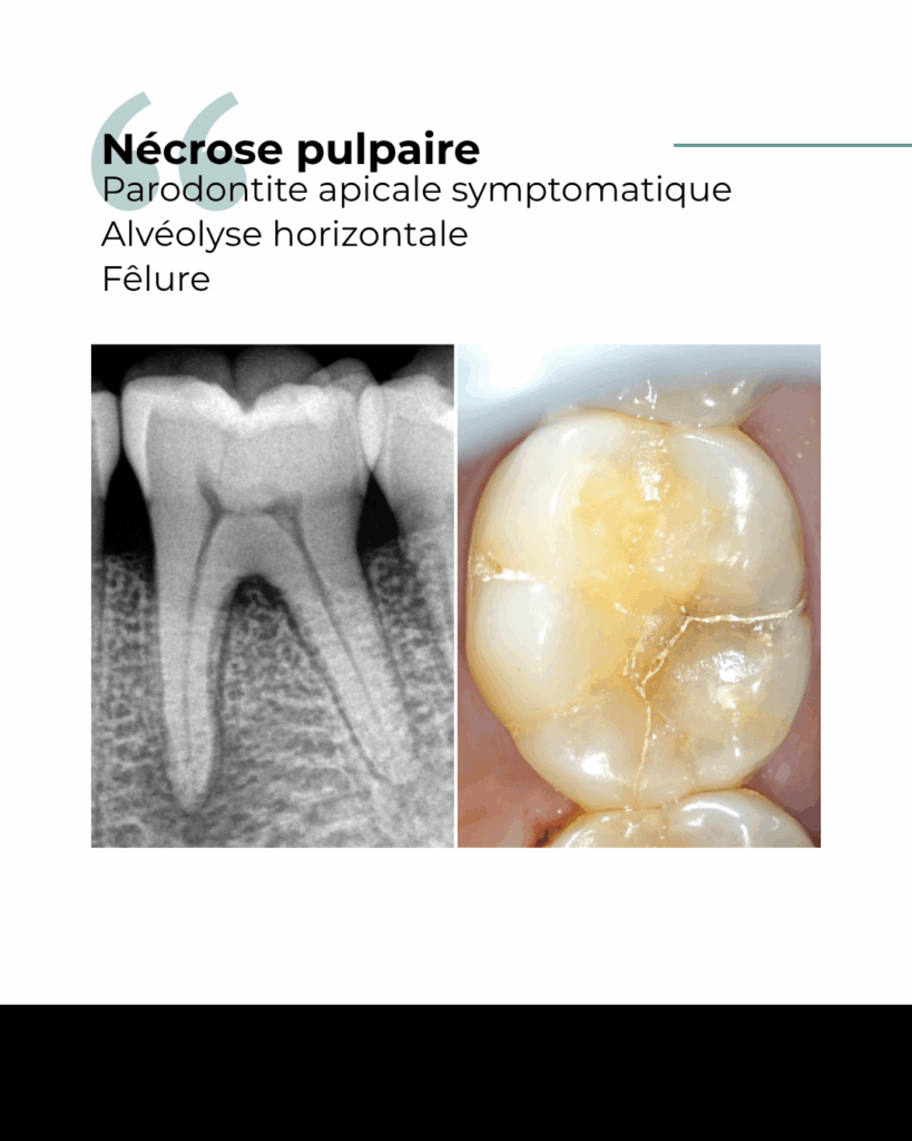 1 BLOG - Dr Brice Riera - Cas patient