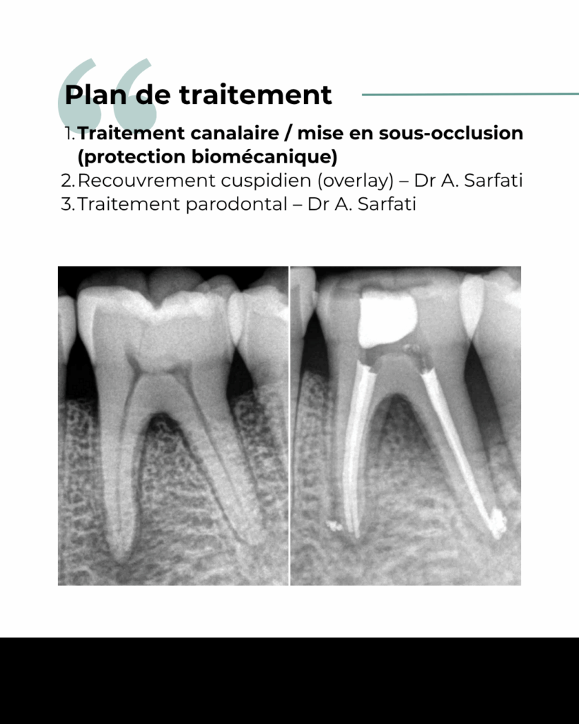 2 1 BLOG - Dr Brice Riera - Cas patient