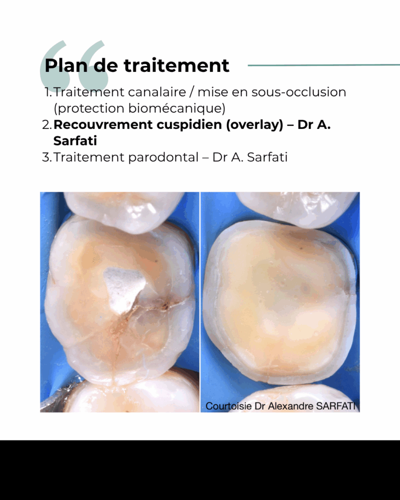 3 2 1 BLOG - Dr Brice Riera - Cas patient