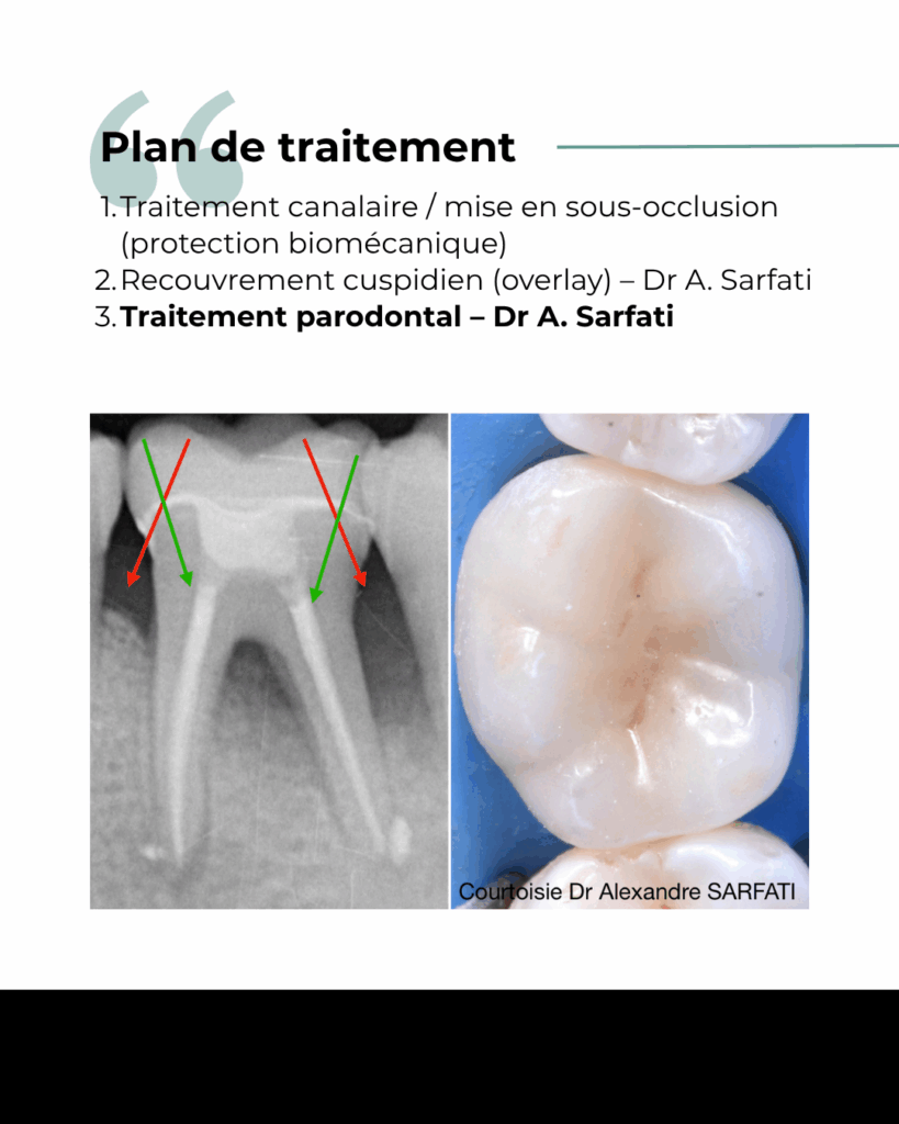 4 3 2 1 BLOG - Dr Brice Riera - Cas patient