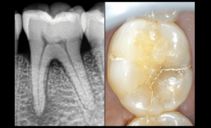 BLOG - Dr Brice Riera - Cas patient