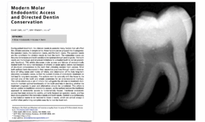 BLOG - Dr Brice Riera - Dentine peri cervicale