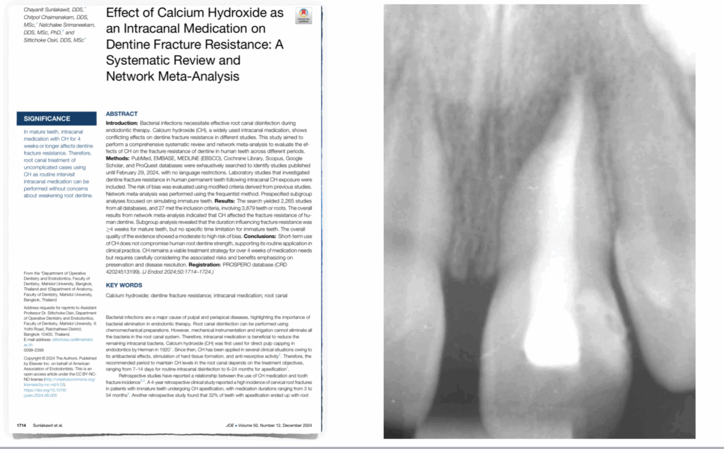 Hydroxyde de calcium