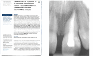 Hydroxyde de calcium