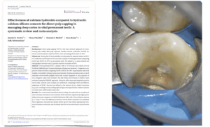 Dr Brice Riera - l’hydroxyde de calcium ou aux ciments hydrauliques à base de silicate de calcium