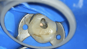 BLOG - Dr Brice Riera - Champ operatoire