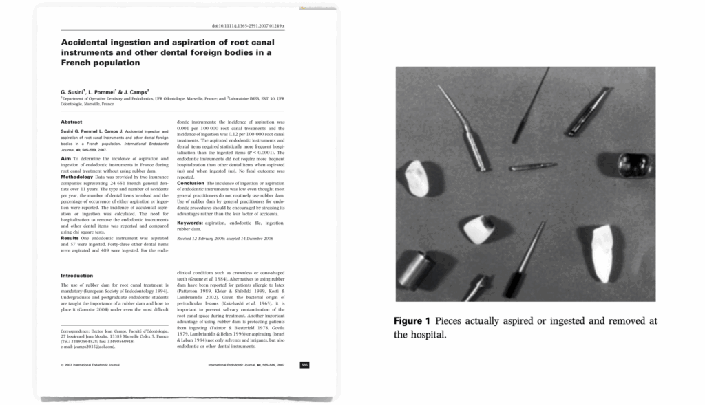 BLOG - Dr Brice Riera - Endodontie - instruments inhales ingeres