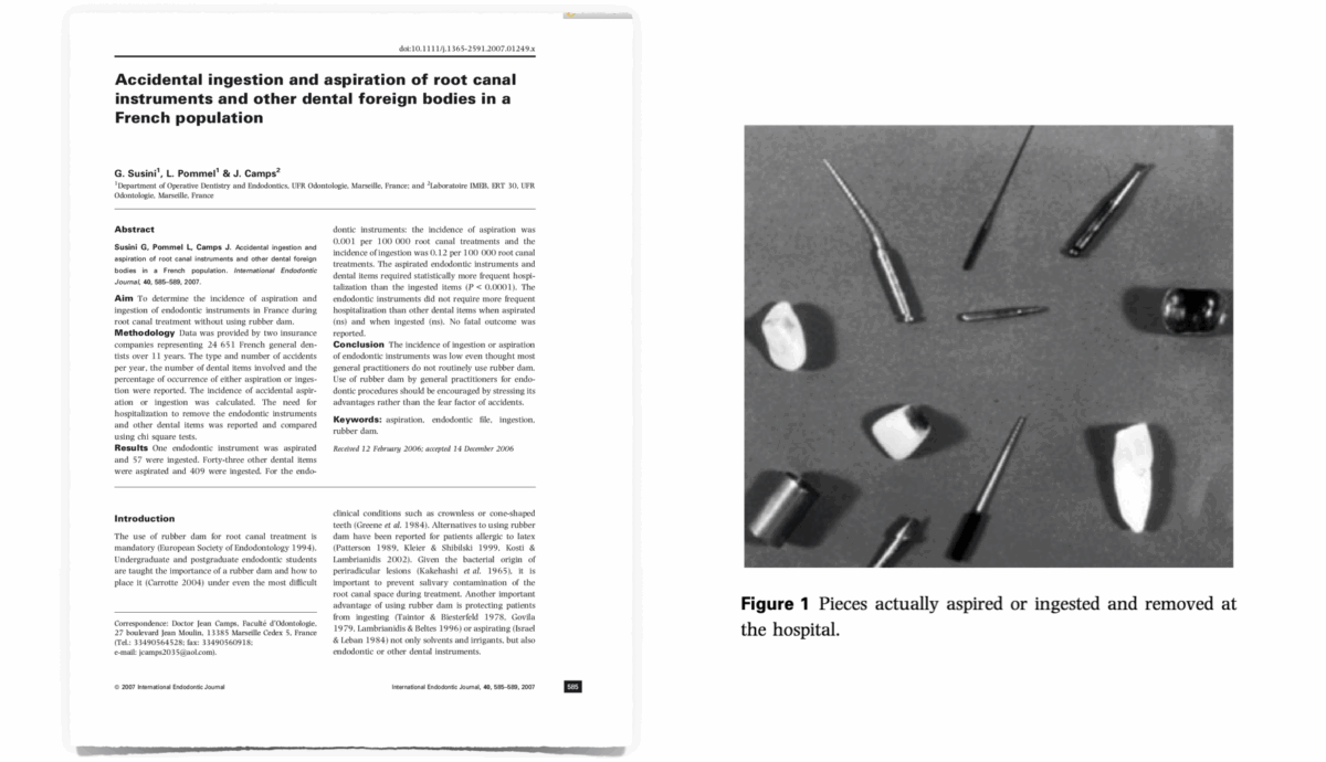 BLOG - Dr Brice Riera - Endodontie - instruments inhales ingeres