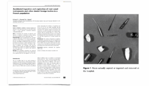 BLOG - Dr Brice Riera - Endodontie - instruments inhales ingeres