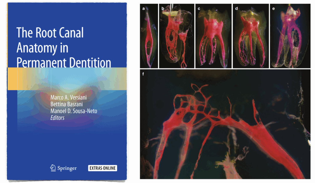 BLOG - Dr Brice Riera - Diaphanisation - endodontie