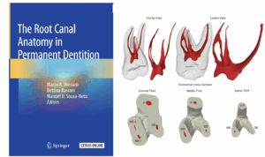 BLOG - Dr Brice Riera - Endodontiste - MV2