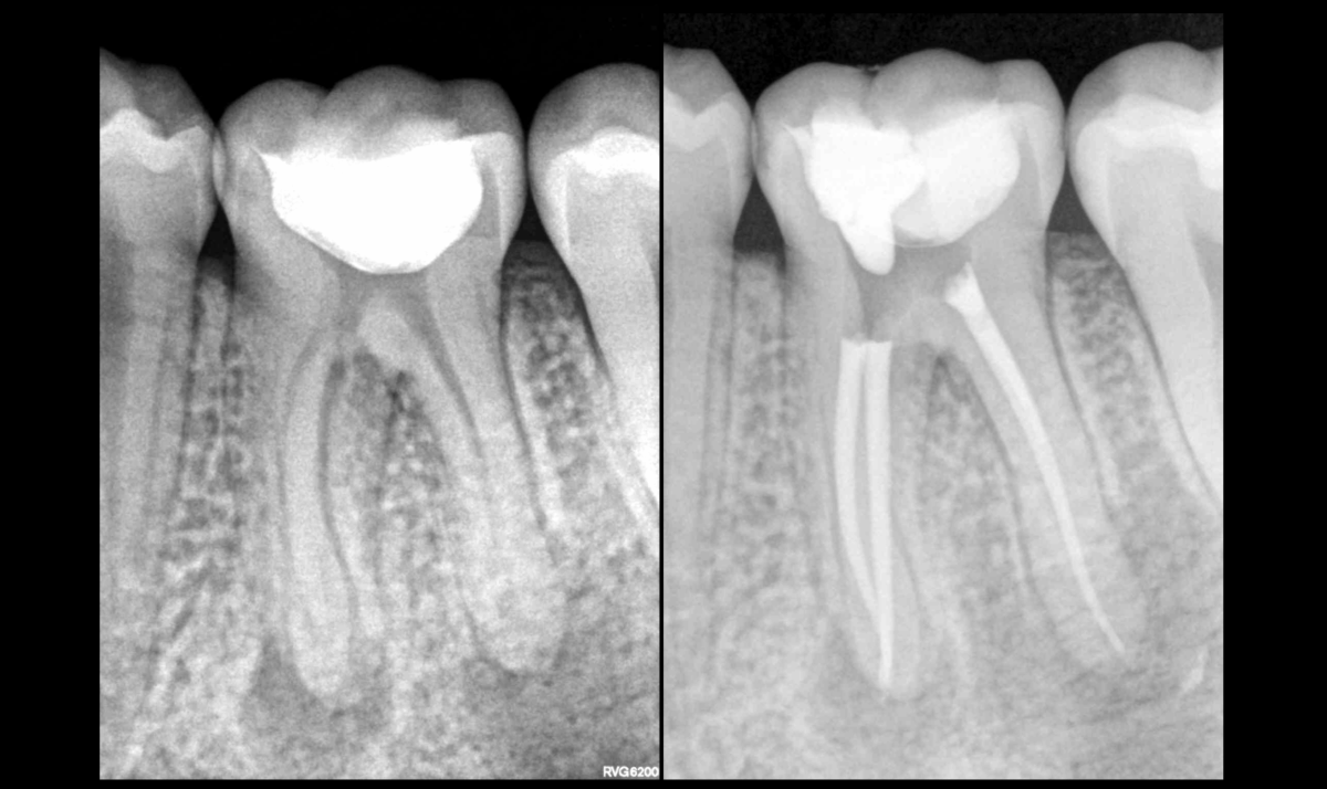 BLOG - Dr Brice Riera - Irigation